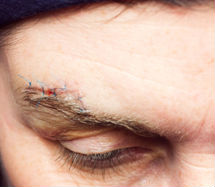 man with a scar above his right eyebrow 